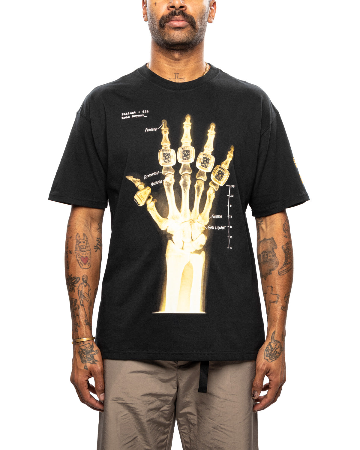 Kobe X-Ray Tee 'Black'